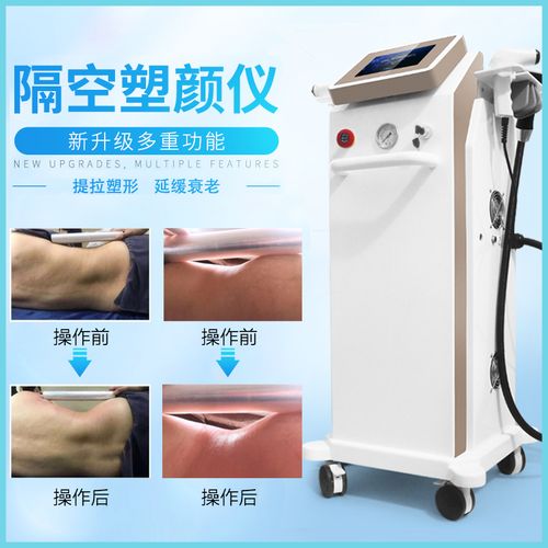 特價(jià)溶脂瘦身 碎脂機(jī)